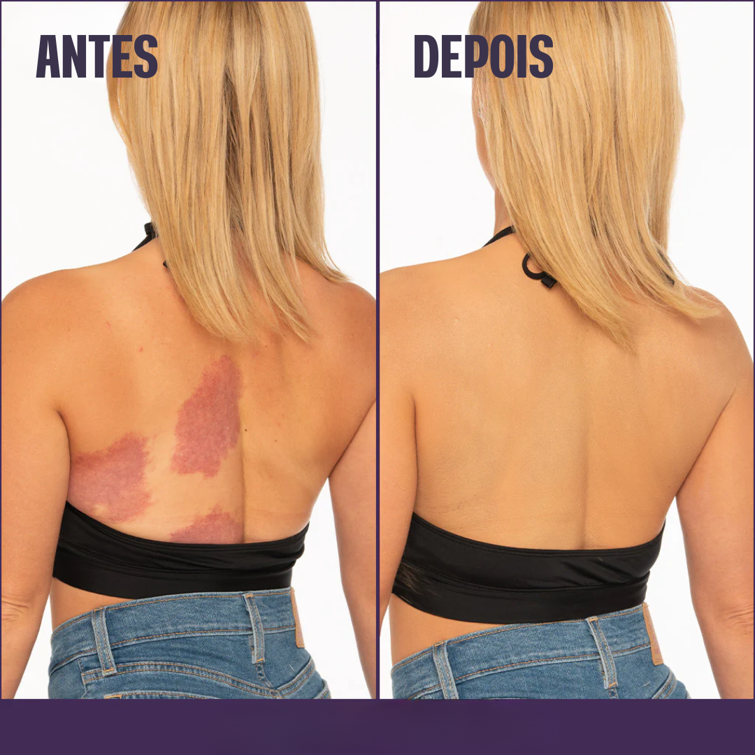 Base Corporal Iluminadora - Remove Manchas✨