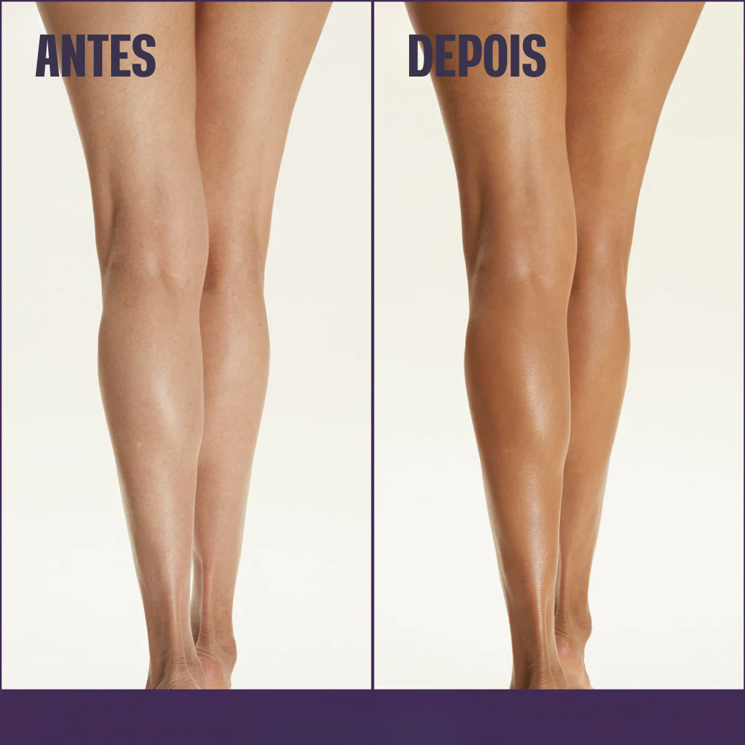 Base Corporal Iluminadora - Remove Manchas✨