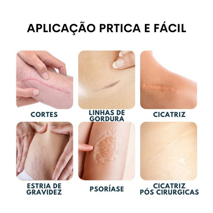 Scar - Gel Cicatrizante 100% Avançado