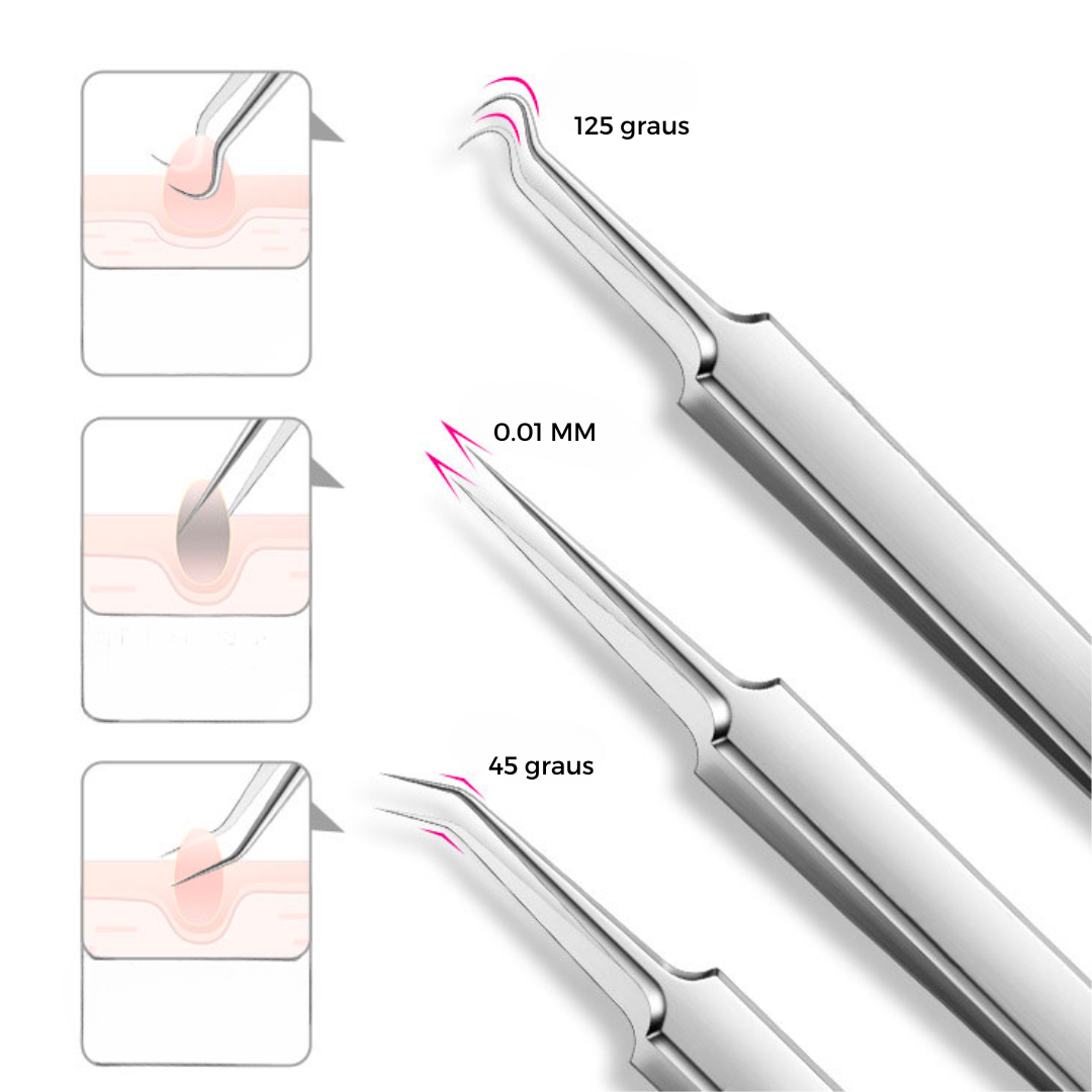 Pinça de Precisão - Remoção Fácil e Eficiente