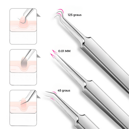 Pinça de Precisão - Remoção Fácil e Eficiente