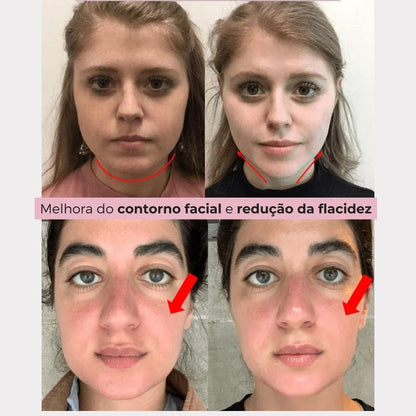 V- LiftUp - Máscara Coreana - Levanta o rosto, suaviza rugas e reduz papada