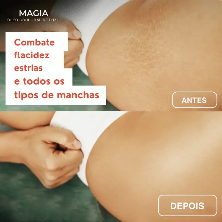 GlowEssence™ | Firma a pele flácida em 97% em apenas 24 horas!